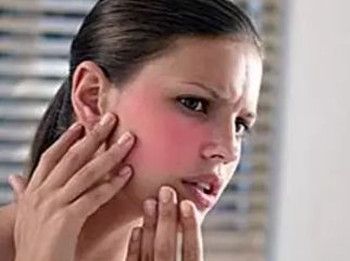 脸上过敏红血丝怎么办，逐步解决恢复健康肌肤