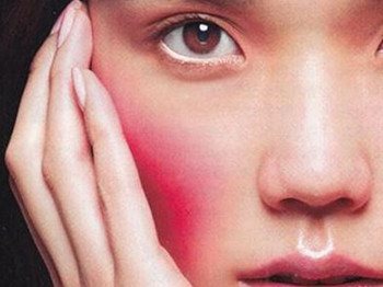 激素脸红血丝怎么消除，从根源解决做起