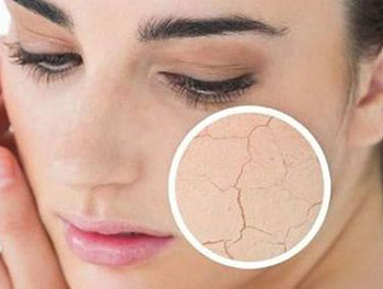 擦完护肤品脸热脸红是缺水吗，肌肤不适原因大分析