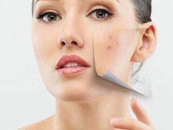 激素脸为什么晚上痒呢，两大因素告诉你答案