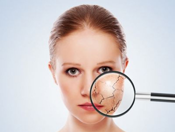 激素脸可以用宝宝霜吗，教你正视激素脸修复  激素脸 宝宝霜 美白祛黄 第2张