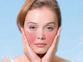 皮肤化妆品过敏怎么办，四步解决