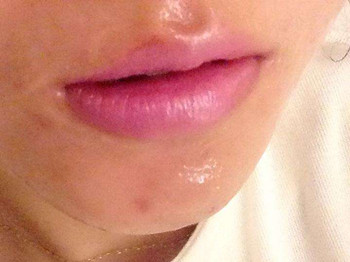 皮肤化妆品过敏怎么办，四步解决  化妆品 过敏 美白祛黄 第2张