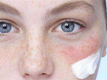 护肤品过敏测试怎么做，简单好学的方法