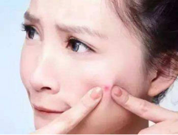 脸水乳过敏什么症状，五个症状确定肌肤过敏  水乳 过敏 美白祛黄 第2张