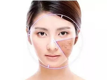 轻度激素脸有什么症状，怎么调理  轻度激素脸 美白祛黄 第2张