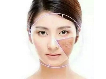 激素脸如何调理，要对症治疗