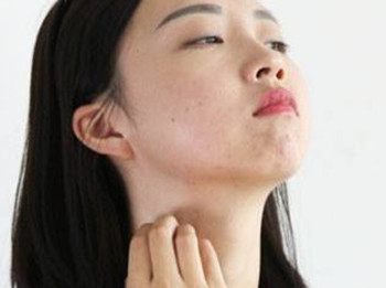 脸又红又肿又痒还很烫怎么办  过敏 激素脸 美白祛黄 第3张