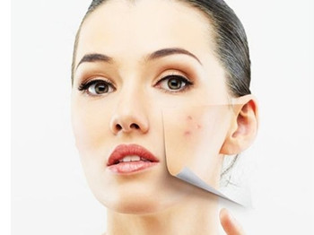 敏感肌肤的种类和注意事项，你是哪一种敏感肌  敏感肌肤 美白祛黄 第3张