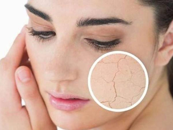 皮肤屏障受损伤的常见原因是什么  皮肤屏障 美白祛黄 第4张