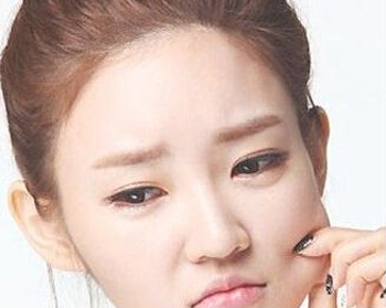 怎么判定皮肤屏障受损，有哪些表现