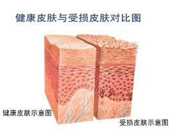 皮肤屏障受损毛孔堵塞长小疙瘩怎么办