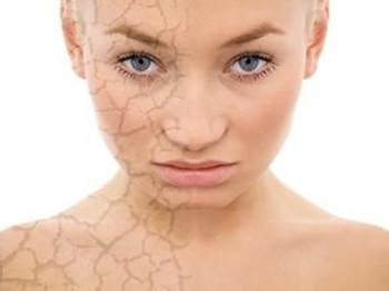 春天脸干起皮怎么办