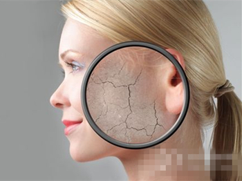 春天脸干起皮怎么办  脸干起皮 美白祛黄 第2张