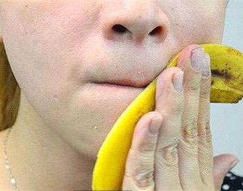 香蕉皮对激素脸的作用有吗？  激素脸 美白祛黄 第2张