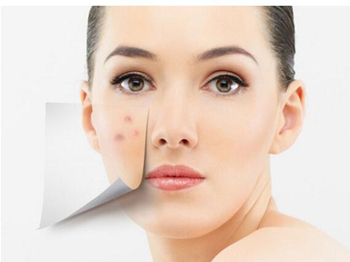 母亲是激素脸会遗传给宝宝吗