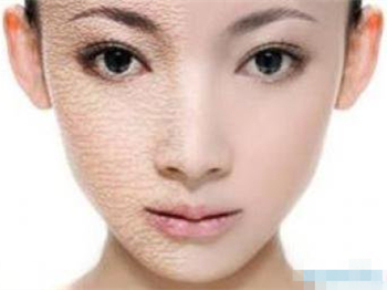 脸上一用护肤品就过敏红痒怎么办  过敏 怎么办 美白祛黄 第2张