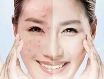 怎样知道脸上有激素、铅汞