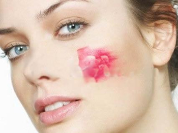 脸皮肤缺水过敏了怎么办  过敏 怎么办 美白祛黄 第2张