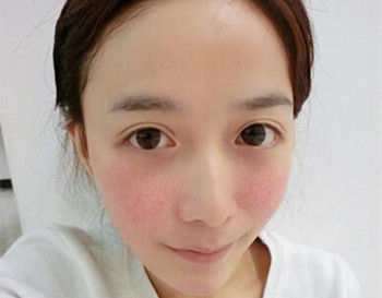 敏感肌肤测试小方法是什么  方法 美白祛黄 第2张