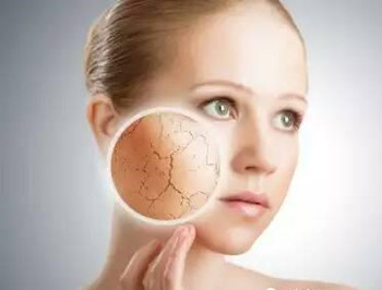 轻度激素脸怎么治，多久能恢复