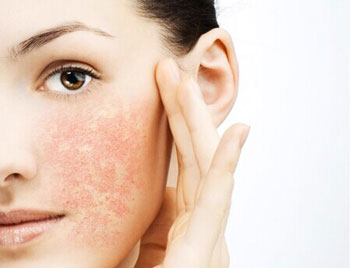 缺水性敏感肌肤过敏怎么办