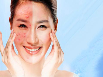 激素脸可以敷海藻面膜吗