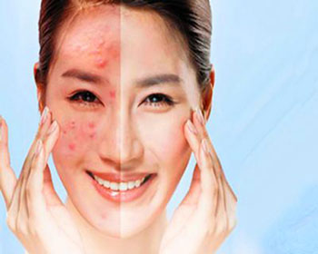 脸上过敏一般几天能好  脸上过敏 几天好 美白祛黄 第3张