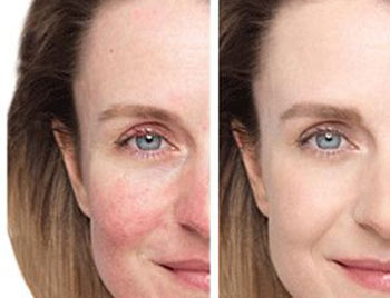 慕兰婷黄金原浆好用吗，安全不  慕兰婷 美白祛黄 第3张