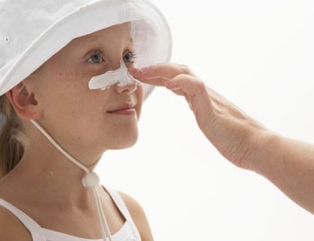 面部毛细血管扩张是什么原因怎么治疗  毛细血管 面部 原因 美白祛黄 第4张