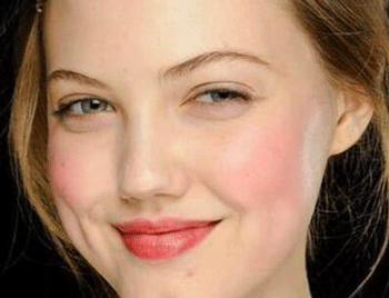 天生脸红怎么治8招教你去红