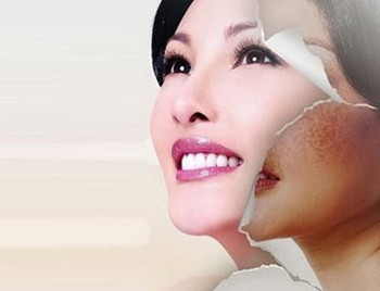 激素脸好了后如何护理