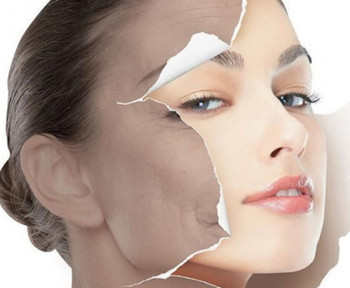 激素脸好了后如何护理  激素脸 美白祛黄 第3张