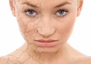 脸上过敏是什么样子