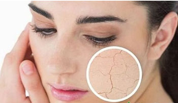 脸上过敏起皮怎么办才好，如何进行修复