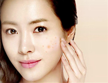 激素脸恢复需要多久，排毒期需要几天