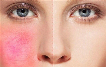 更年期面色潮红潮热应该怎么护理  更年期 美白祛黄 第1张