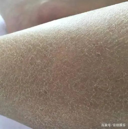 夏日不防晒，秒变「小黑娃」李现肖战简单粗暴  防晒 第3张