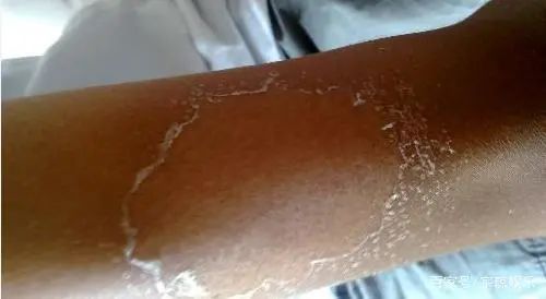 夏日不防晒，秒变「小黑娃」李现肖战简单粗暴  防晒 第4张