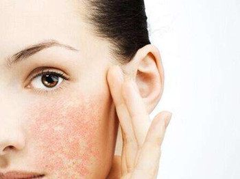 擦完护肤品脸热脸红什么原因怎么办  护肤品 怎么办 原因 美白祛黄 第3张