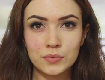 面部潮红和红血丝区别，4种方法快速区别  红血丝 面部潮红 美白祛黄 第2张