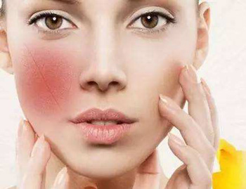 补水后脸上泛红刺痛为什么，这种情况怎么办  皮肤泛红 美白祛黄 第2张