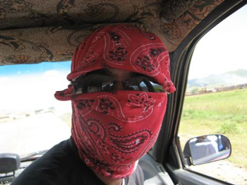 脸部高原红能自己消失吗，  脸部高原红 美白祛黄 第4张