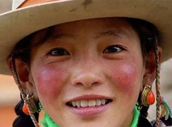 面色潮红皮肤发热是什么原因  什么原因 美白祛黄 第2张