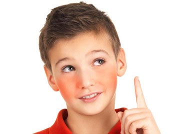 8岁男孩脸总是潮红，不知道的妈妈要注意了