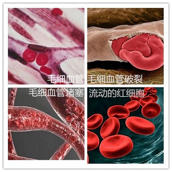 脸红有血丝怎么办，用什么护肤品