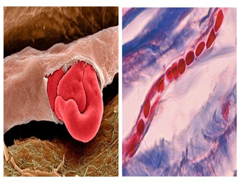 脸红是什么原因造成的，最有效的不脸红的方法