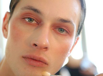 男生脸上的高原红怎么去掉