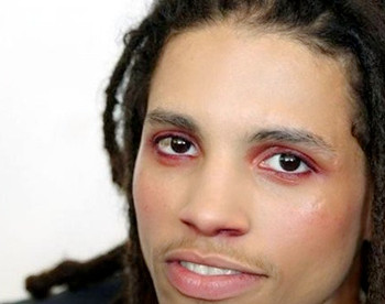 高原红是怎么回事，什么原因引起  怎么回事 什么原因 美白祛黄 第3张