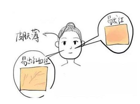 皮肤过敏和角质层薄有关系吗  皮肤过敏 美白祛黄 第4张